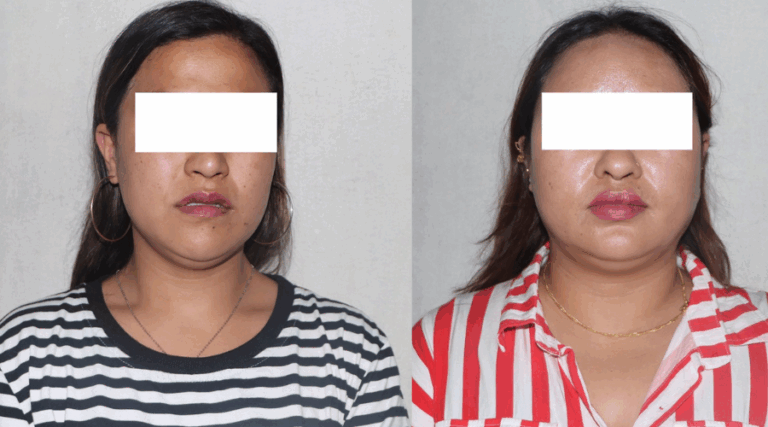 फेसबुकबाट हनी ट्रयाप’मा पारेर ब्ल्याकमेलगर्ने दुई युवती पक्राउ