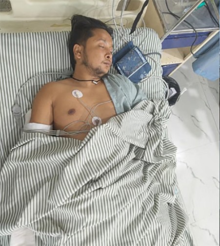 इण्डियन आइडल’ विजेता पवनदीप कार दुर्घटनामा गम्भीर घाइते, दिल्लीमा उपचार जारी